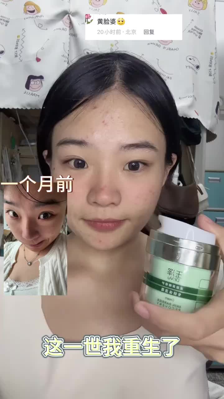 靠！哪个脆皮大学生还不知道这个烂脸救星