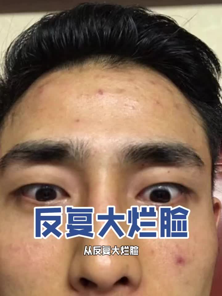 7天见效！12年豆肌快速祛豆祛印猛药！