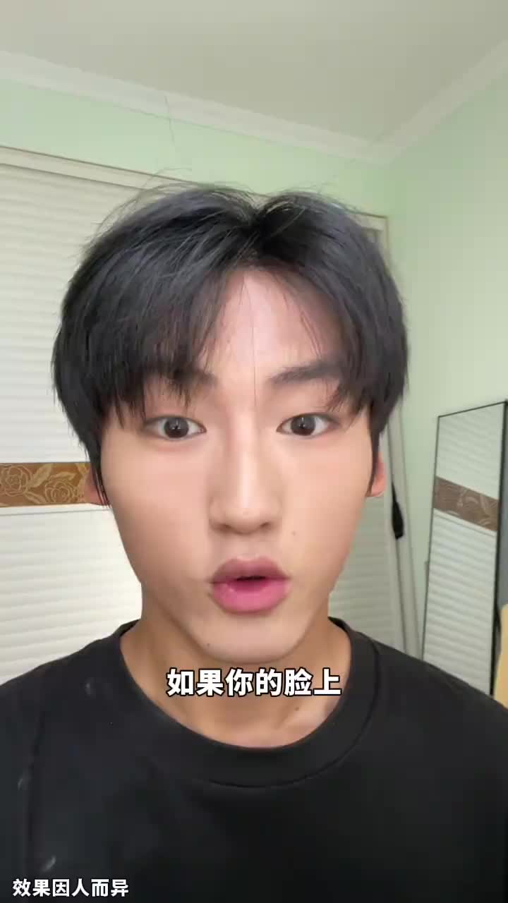 不火天理难容！他真的跟油痘肌拼命啊！！！