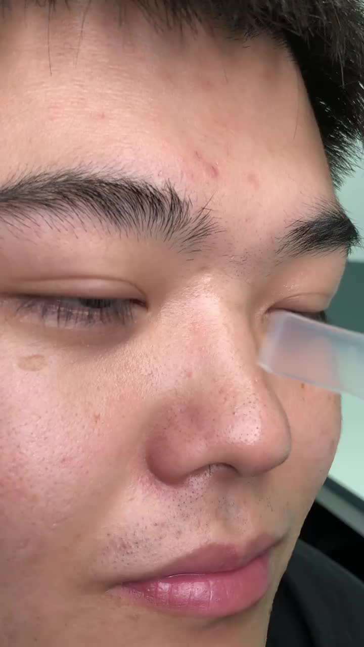 洗面奶解决不了的草莓鼻！我海洋至尊泥膜替