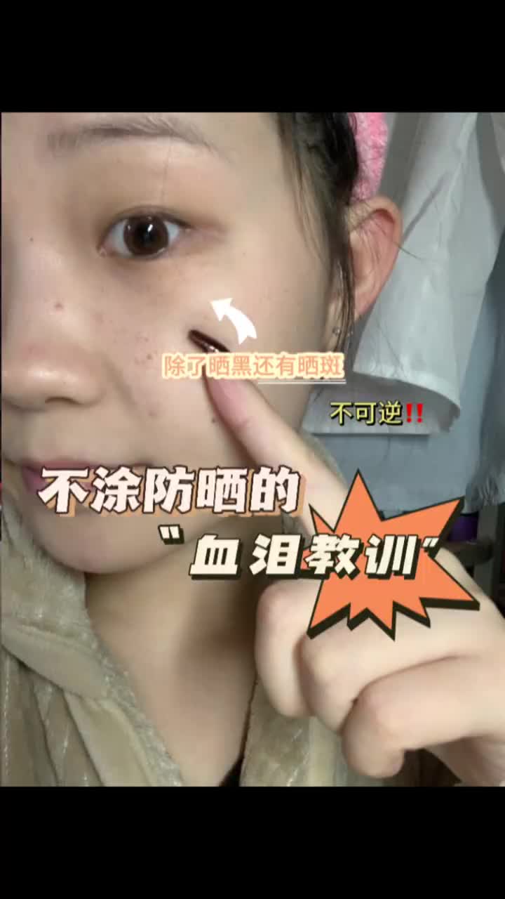 听姐妹一句劝！真的要涂防晒！“血泪”教训⚠️