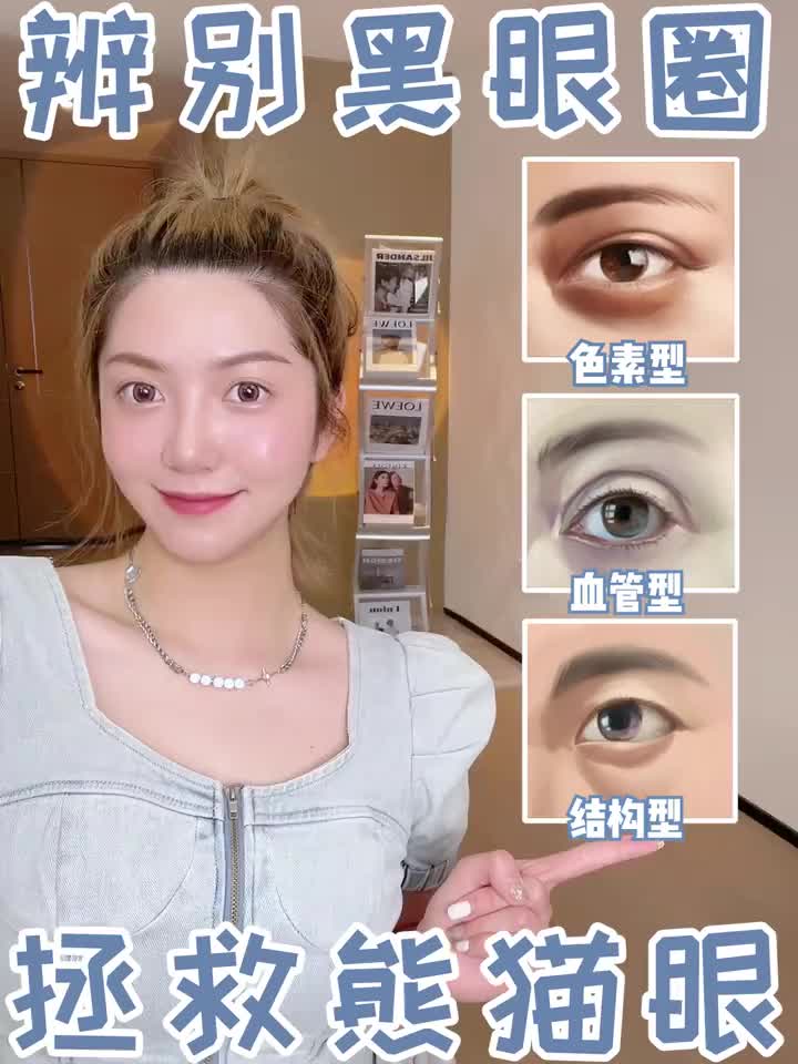 黑眼圈⁉️4⃣️种详细分类🔆保姆级改善法👍