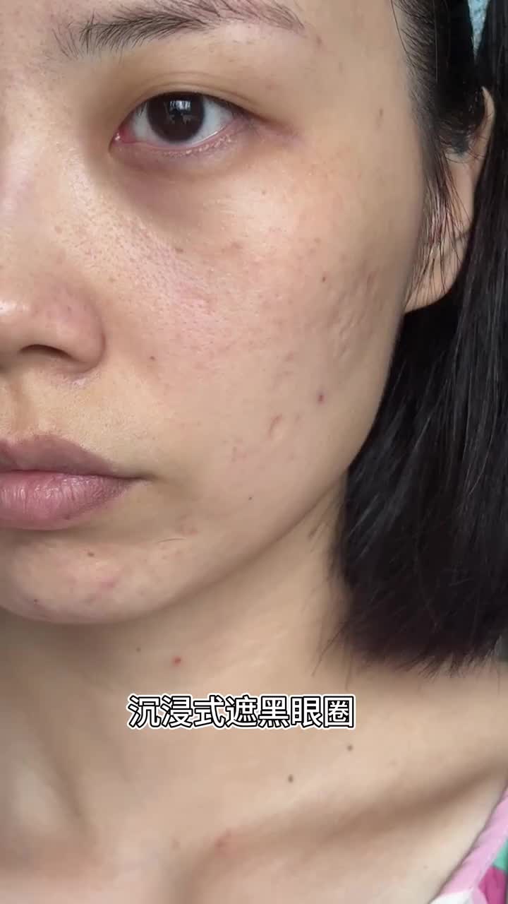 重度黑眼圈这样遮