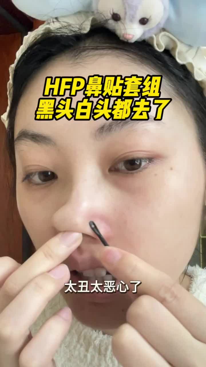 去黑头神器！！！不撕拉的鼻贴才是好鼻贴！