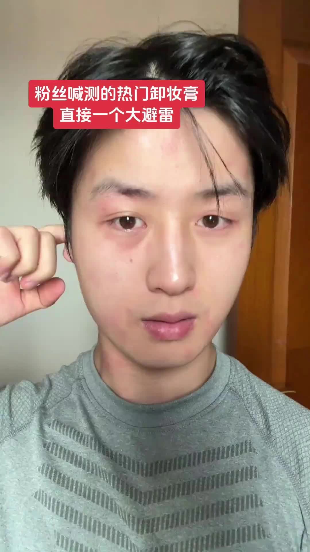 敏肌别用了！我基本不敏卸妆膏的！这是第一次测评卸妆膏过敏！