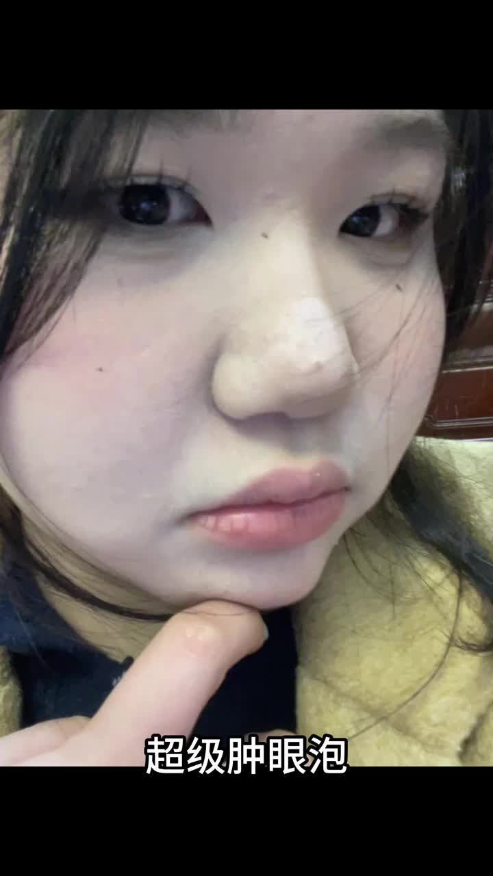 肿眼泡化妆有难度？？？